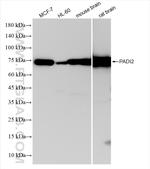 PADI2 Antibody in Western Blot (WB)