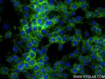 Ncam1 Antibody in Immunocytochemistry (ICC/IF)