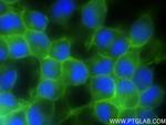 Ncam1 Antibody in Immunocytochemistry (ICC/IF)