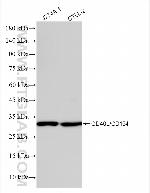 CD40L/CD154 Antibody in Western Blot (WB)