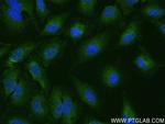 UBAP2 Antibody in Immunocytochemistry (ICC/IF)