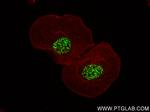 ETV4 Antibody in Immunocytochemistry (ICC/IF)