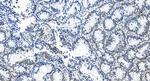 ETV4 Antibody in Immunohistochemistry (Paraffin) (IHC (P))