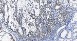 ETV4 Antibody in Immunohistochemistry (Paraffin) (IHC (P))