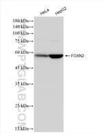FOXN2 Antibody in Western Blot (WB)
