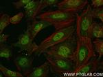 VPRBP Antibody in Immunocytochemistry (ICC/IF)