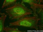 VPRBP Antibody in Immunocytochemistry (ICC/IF)