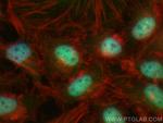 VPRBP Antibody in Immunocytochemistry (ICC/IF)
