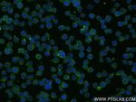 B7H6 Antibody in Immunocytochemistry (ICC/IF)