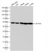 ZFP161/ZBTB14 Antibody in Western Blot (WB)