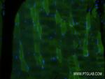 FBP2 Antibody in Immunohistochemistry (PFA fixed) (IHC (PFA))