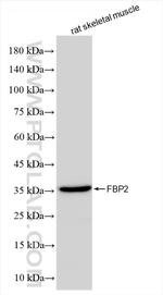 FBP2 Antibody in Western Blot (WB)