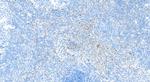 VISTA Antibody in Immunohistochemistry (Paraffin) (IHC (P))