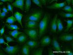 BUB1B Antibody in Immunocytochemistry (ICC/IF)