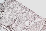 BUB1B Antibody in Immunohistochemistry (Paraffin) (IHC (P))