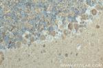 Synaptotagmin-14 Antibody in Immunohistochemistry (Paraffin) (IHC (P))