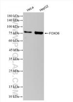 FOXO6 Antibody in Western Blot (WB)