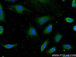 ANXA5 Antibody in Immunocytochemistry (ICC/IF)