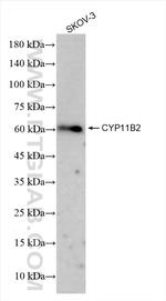 CYP11B2 Recombinant Rabbit Monoclonal Antibody (240811E7)