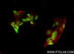 EOMES Antibody in Immunocytochemistry (ICC/IF)