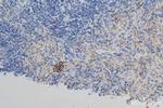 Selp/P-selectin Antibody in Immunohistochemistry (Paraffin) (IHC (P))