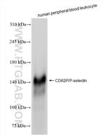 Selp/P-selectin Antibody in Western Blot (WB)