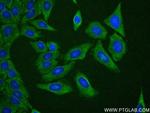HSP90 Antibody in Immunocytochemistry (ICC/IF)