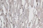 ATP6V1B1 Antibody in Immunohistochemistry (Paraffin) (IHC (P))