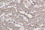 ATP6V1B1 Antibody in Immunohistochemistry (Paraffin) (IHC (P))