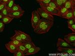 TLE3 Antibody in Immunocytochemistry (ICC/IF)