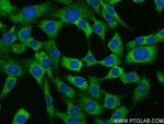ADIPOQ Antibody in Immunocytochemistry (ICC/IF)