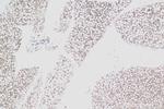 ADIPOQ Antibody in Immunohistochemistry (Paraffin) (IHC (P))