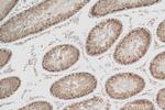 YTHDC2 Antibody in Immunohistochemistry (Paraffin) (IHC (P))