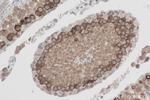 YTHDC2 Antibody in Immunohistochemistry (Paraffin) (IHC (P))