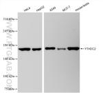 YTHDC2 Antibody in Western Blot (WB)