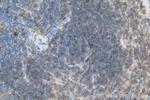 CD40 Antibody in Immunohistochemistry (Paraffin) (IHC (P))