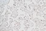 RNGTT Antibody in Immunohistochemistry (Paraffin) (IHC (P))