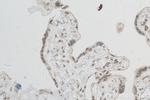 RNGTT Antibody in Immunohistochemistry (Paraffin) (IHC (P))
