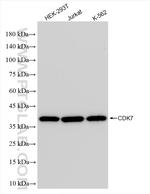 CDK7 Antibody in Western Blot (WB)