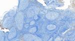 Perforin Antibody in Immunohistochemistry (Paraffin) (IHC (P))