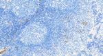 Perforin Antibody in Immunohistochemistry (Paraffin) (IHC (P))