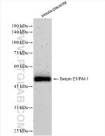 Serpin E1/PAI-1 Antibody in Western Blot (WB)