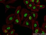 AGXT2L1 Antibody in Immunocytochemistry (ICC/IF)