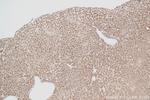 AGXT2L1 Antibody in Immunohistochemistry (Paraffin) (IHC (P))