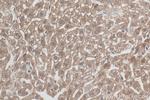 AGXT2L1 Antibody in Immunohistochemistry (Paraffin) (IHC (P))