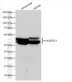 AGXT2L1 Antibody in Western Blot (WB)