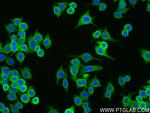 GDF5 Antibody in Immunocytochemistry (ICC/IF)