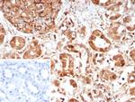 CASP7/Caspase-7 Monoclonal Antibody (CASP7/9051)