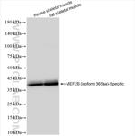 MEF2B Antibody in Western Blot (WB)