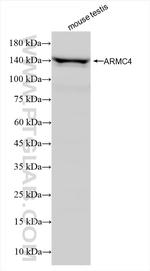 ARMC4 Antibody in Western Blot (WB)